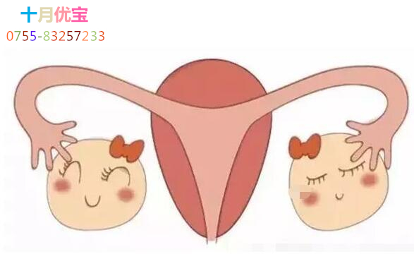 \ 云图片
